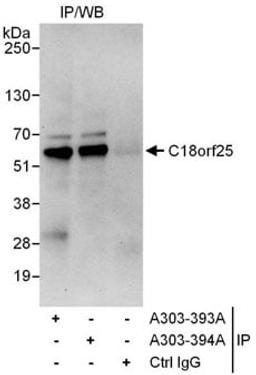 Detection of human C18orf25 by western blot of immunoprecipitates.