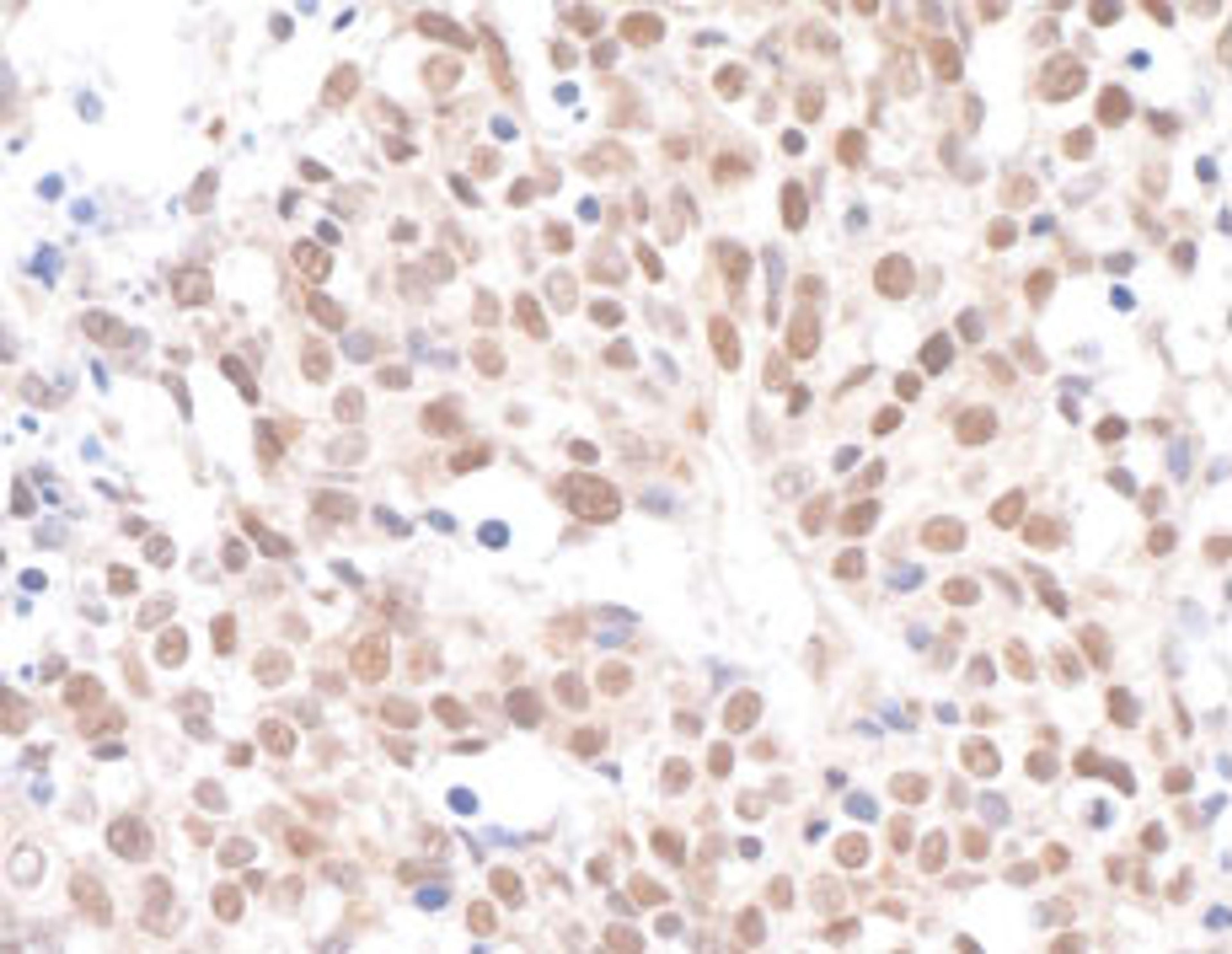 Detection of human Caf1p150 by immunohistochemistry.