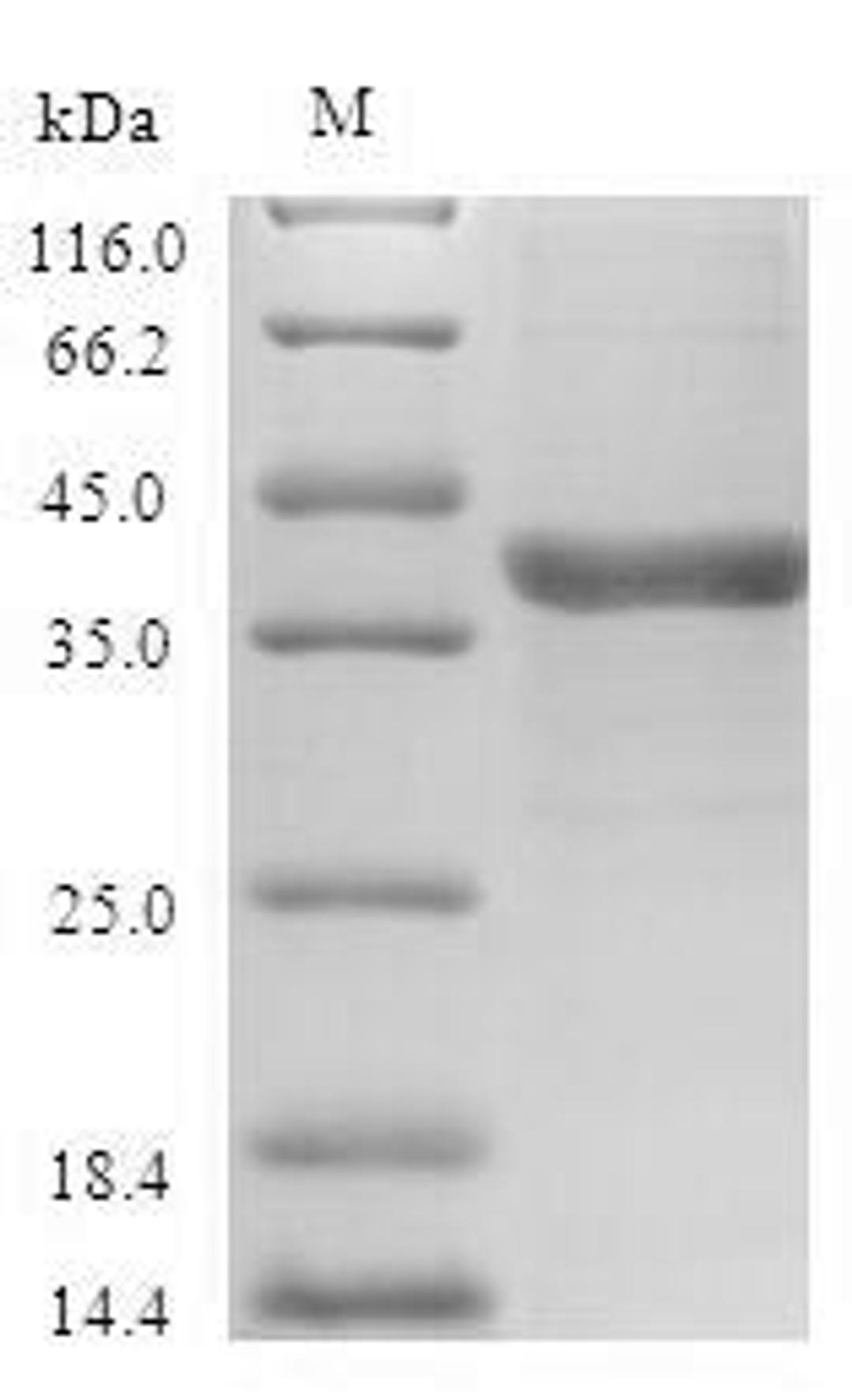(Tris-Glycine gel) Discontinuous SDS-PAGE (reduced) with 5% enrichment gel and 15% separation gel.