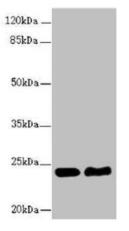 Western blot. All lanes: RAB5B antibody at 5.16µg/ml. Lane 1: Hela whole cell lysate. Lane 2: Jurkat whole cell lysate. Secondary. Goat polyclonal to rabbit IgG at 1/10000 dilution. Predicted band size: 24, 20 kDa. Observed band size: 24 kDa