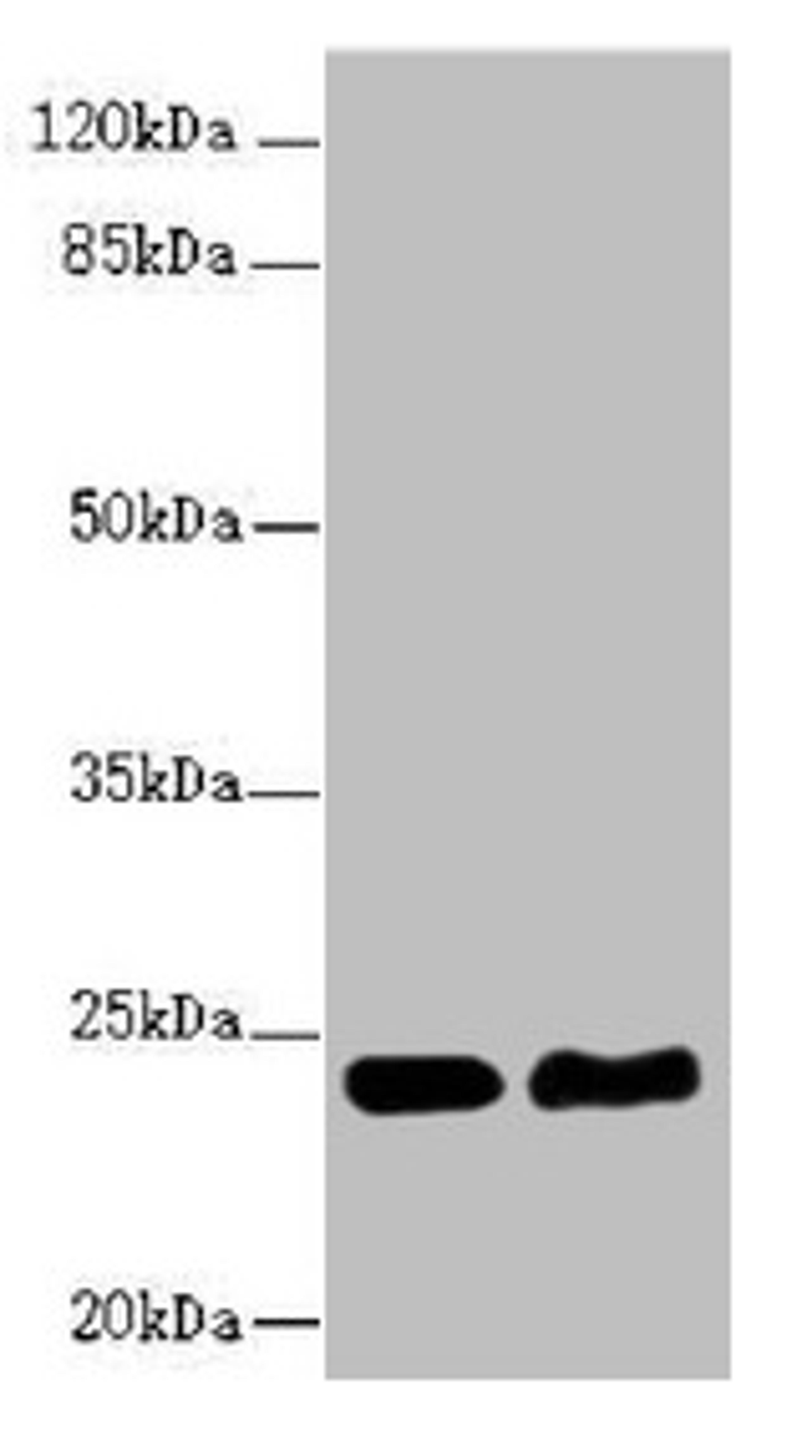 Western blot. All lanes: RAB5B antibody at 5.16µg/ml. Lane 1: Hela whole cell lysate. Lane 2: Jurkat whole cell lysate. Secondary. Goat polyclonal to rabbit IgG at 1/10000 dilution. Predicted band size: 24, 20 kDa. Observed band size: 24 kDa