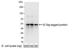 Detection of S-Tag-tagged Protein by WB.