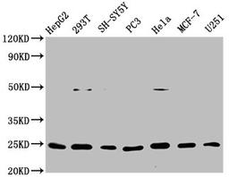 Western Blot. Positive WB detected in: HepG2 whole cell lysate, 293T whole cell lysate, SH-SY5Y whole cell lysate, PC3 whole cell lysate, Hela whole cell lysate, MCF-7 whole cell lysate, U251 whole cell lysate. All lanes: GDNF antibody at 1μg/ml. Secondary. Goat polyclonal to rabbit IgG at 1/50000 dilution. Predicted band size: 24, 21, 26, 23, 19 KDa. Observed band size: 24 KDa. 