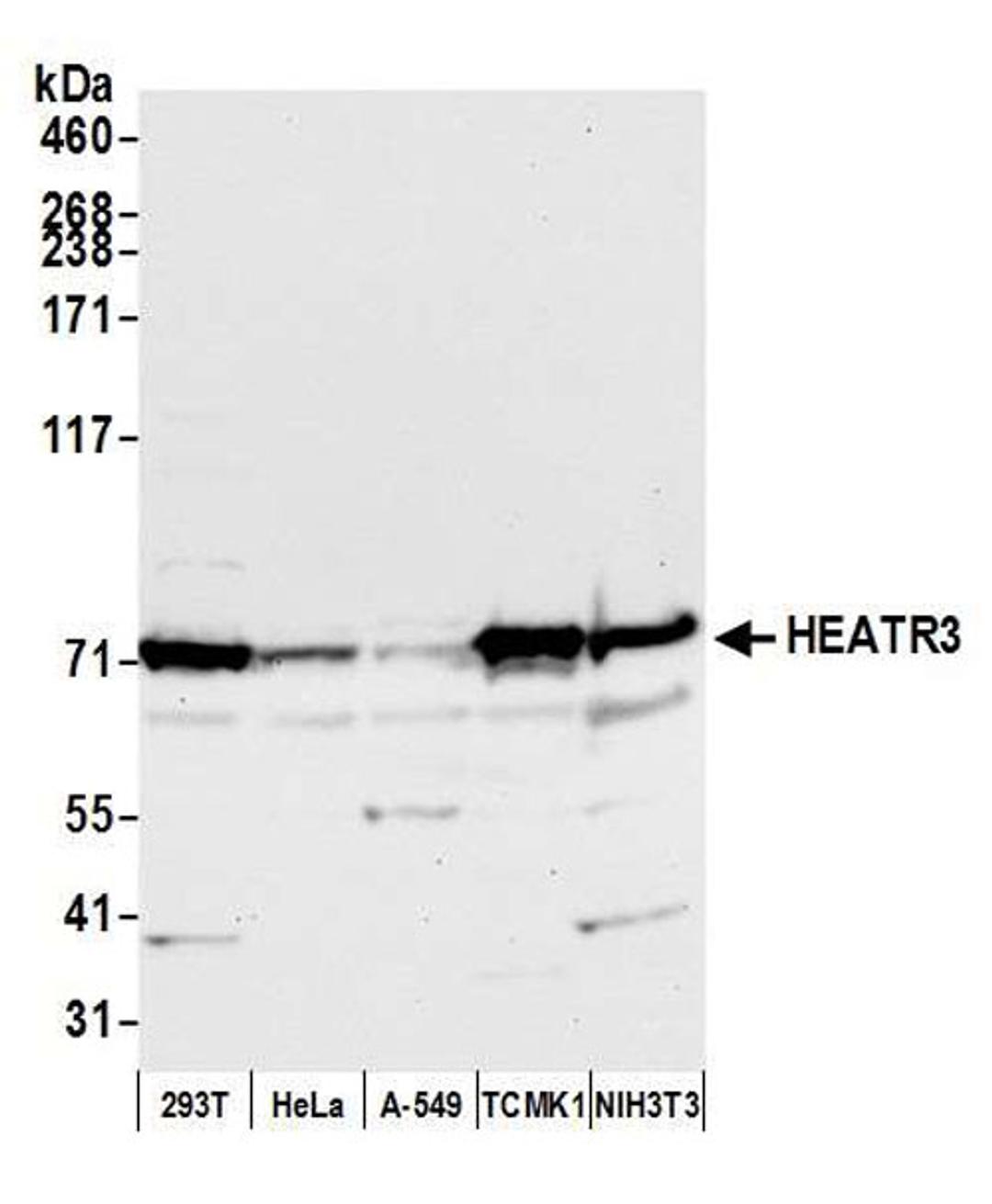 Detection of human and mouse HEATR3 by WB.