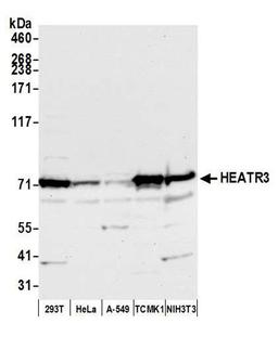 Detection of human and mouse HEATR3 by WB.