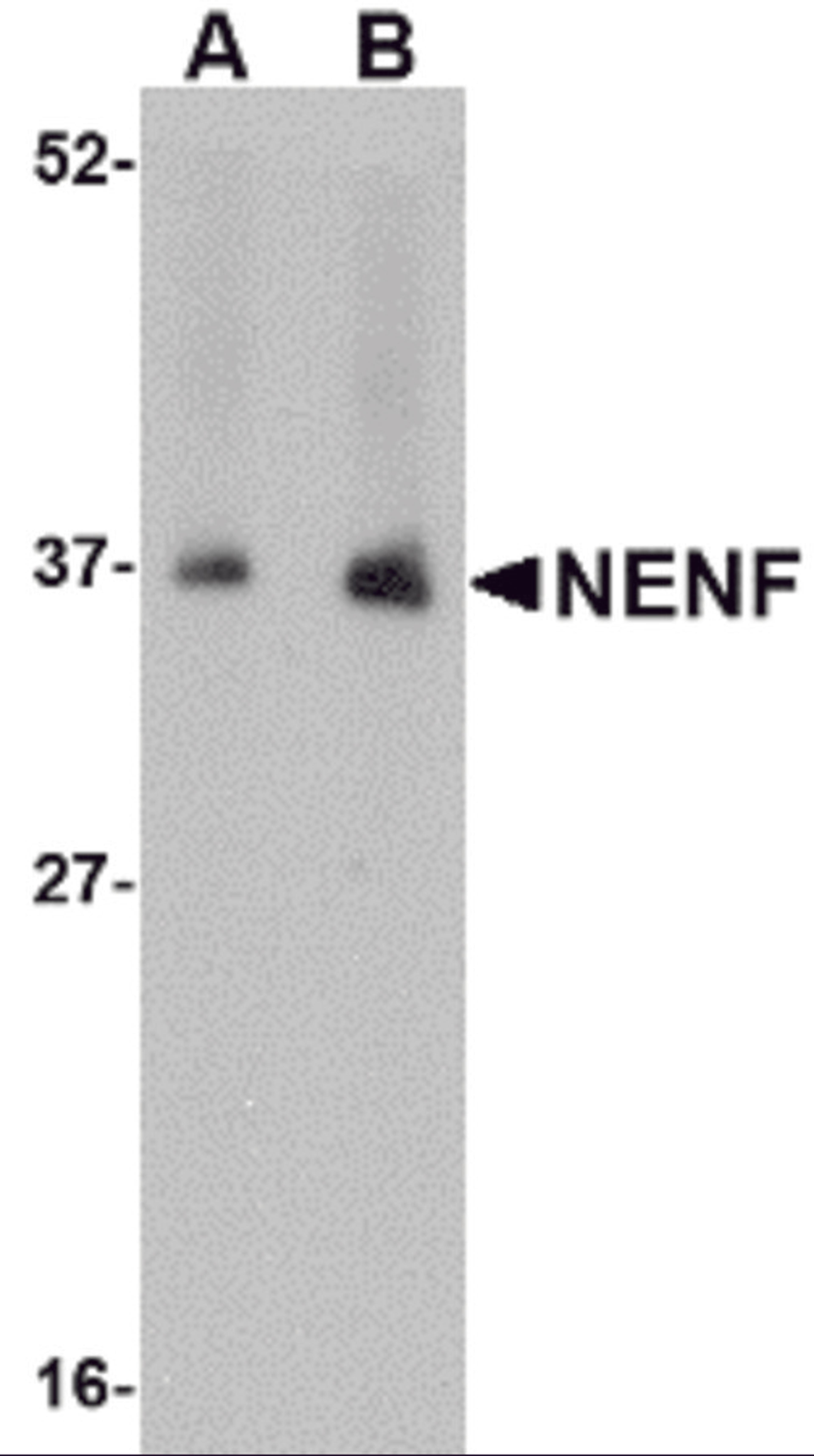 Western blot analysis of NENF in human kidney tissue lysate with NENF antibody at (A) 1 and (B) 2 &#956;g/mL.