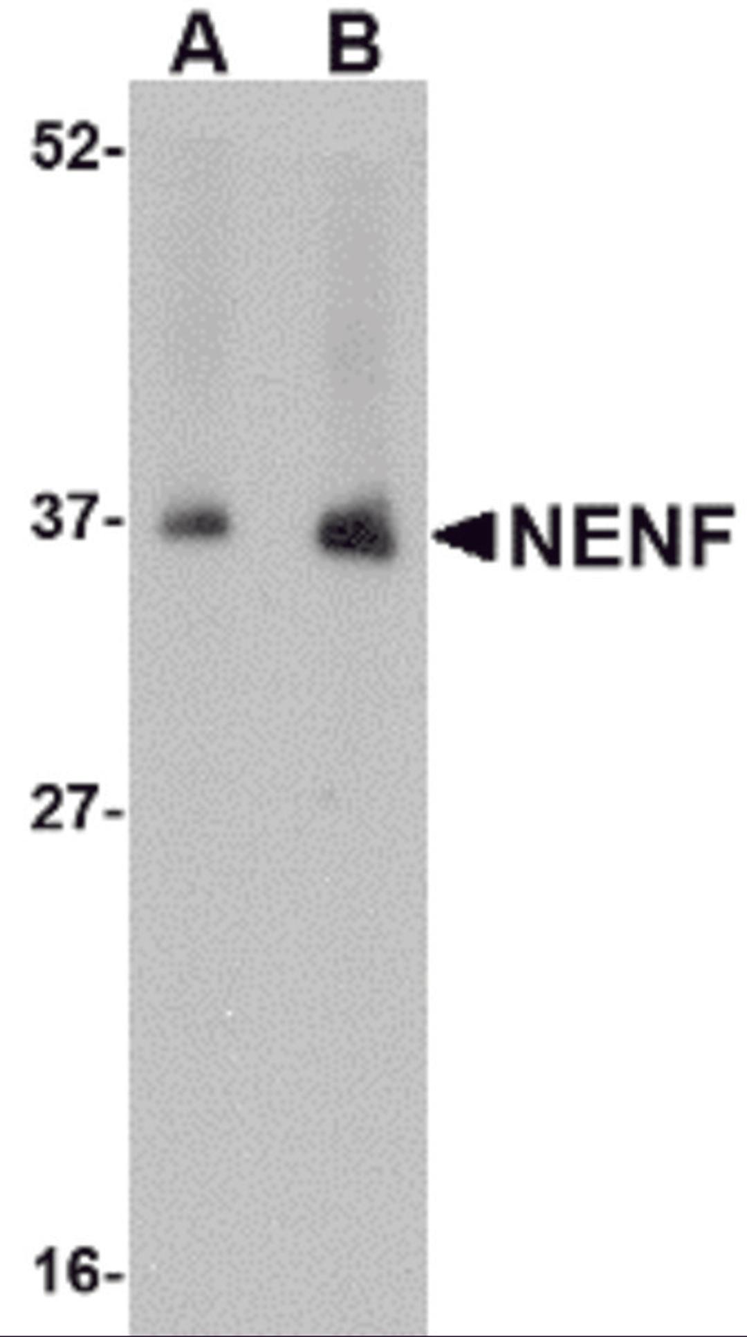 Western blot analysis of NENF in human kidney tissue lysate with NENF antibody at (A) 1 and (B) 2 μg/mL.