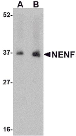 Western blot analysis of NENF in human kidney tissue lysate with NENF antibody at (A) 1 and (B) 2 μg/mL.
