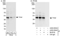 Detection of human Ymer by western blot and immunoprecipitation.