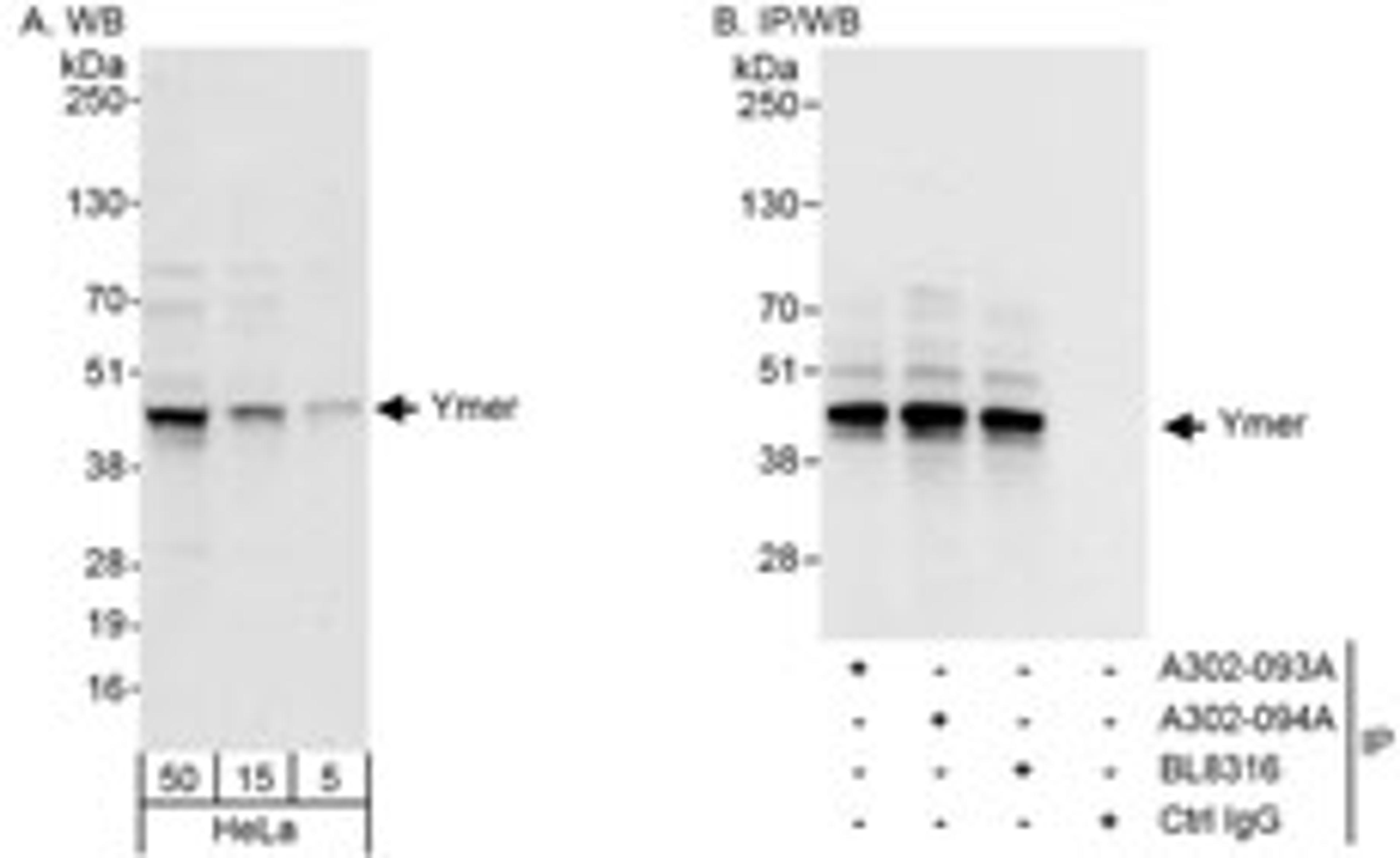 Detection of human Ymer by western blot and immunoprecipitation.