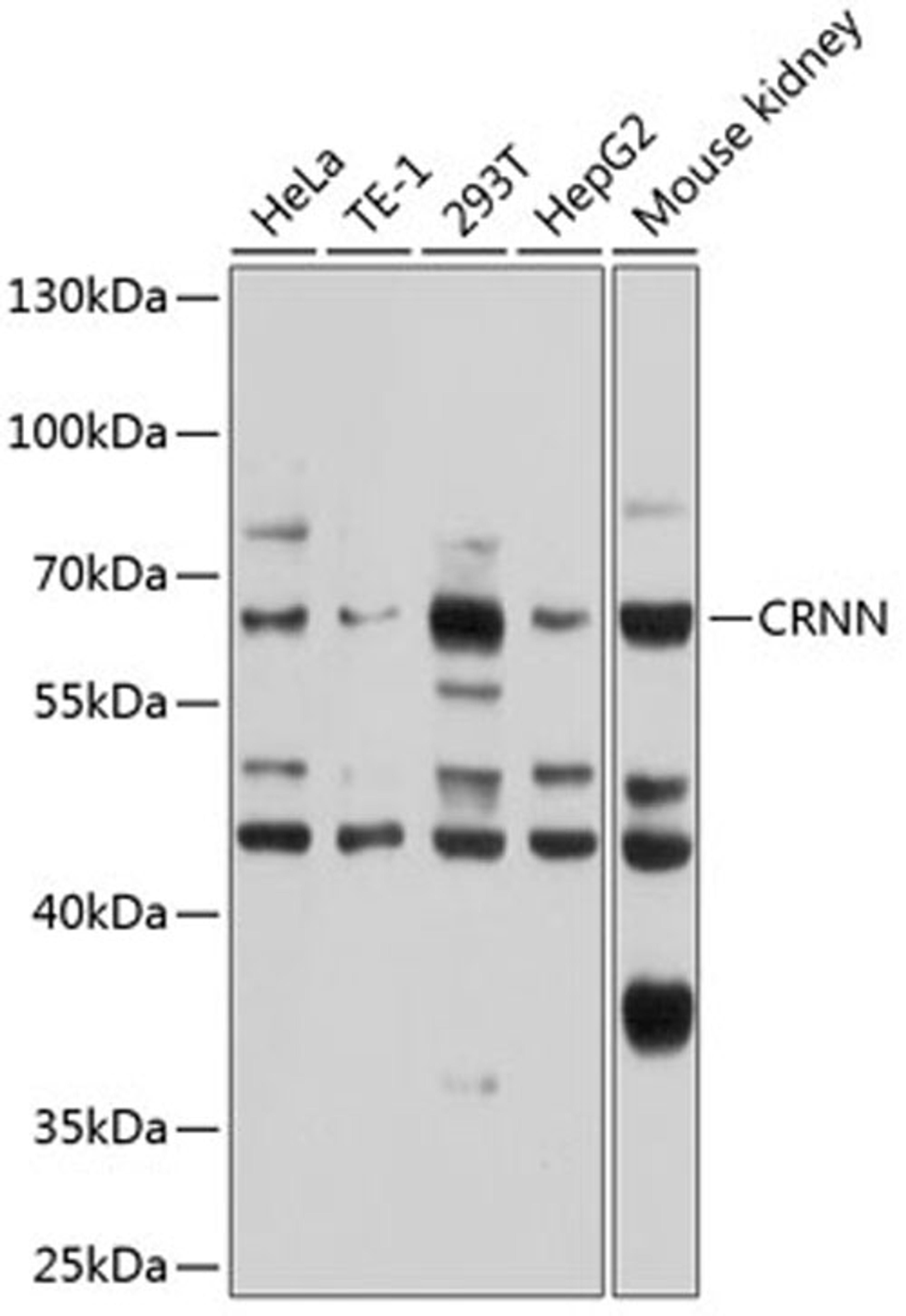 Western blot - CRNN antibody (A8762)