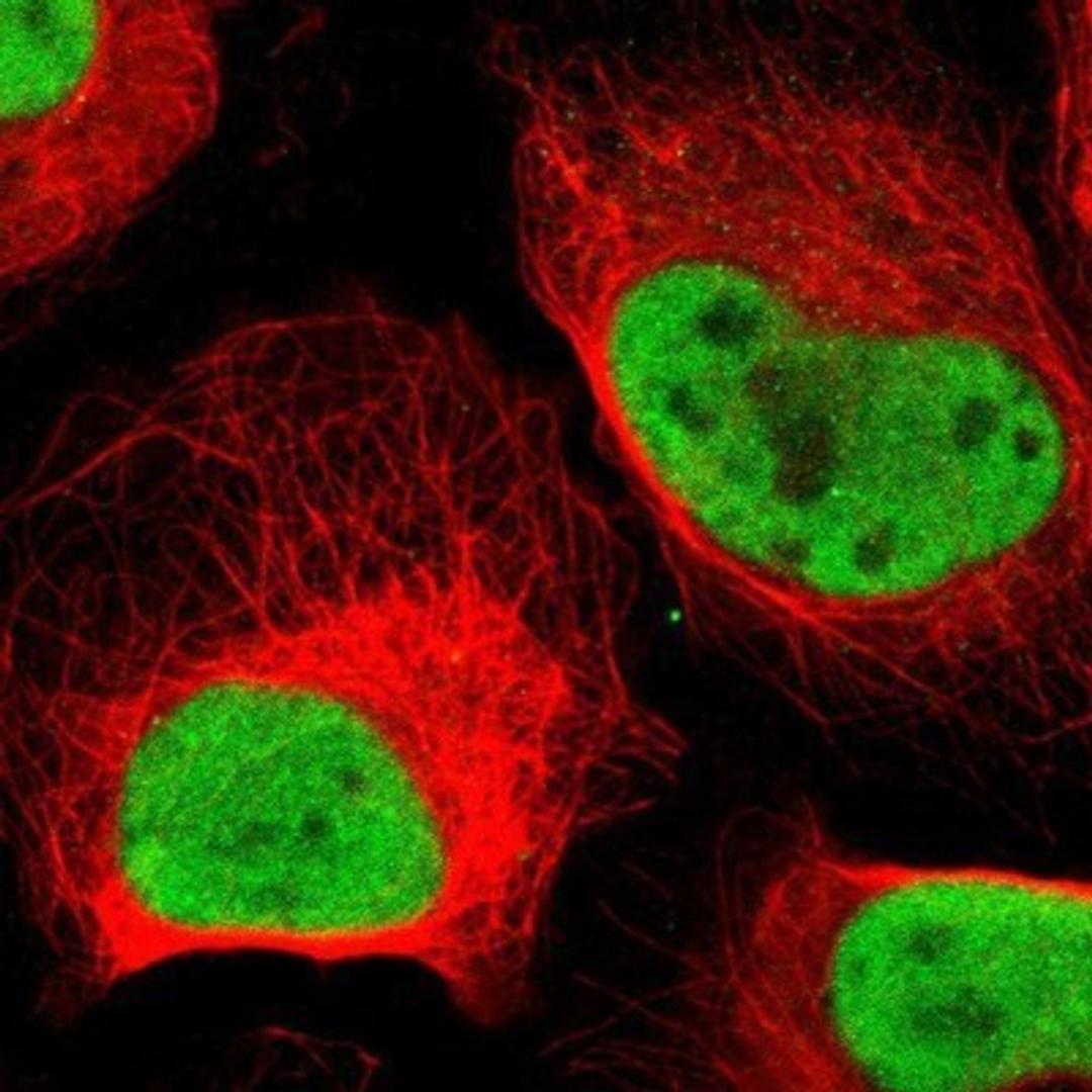 Immunocytochemistry/Immunofluorescence: MCM6 Antibody [NBP1-82642] - Staining of human cell line U-2 OS shows positivity in nuclei but not nucleoli.