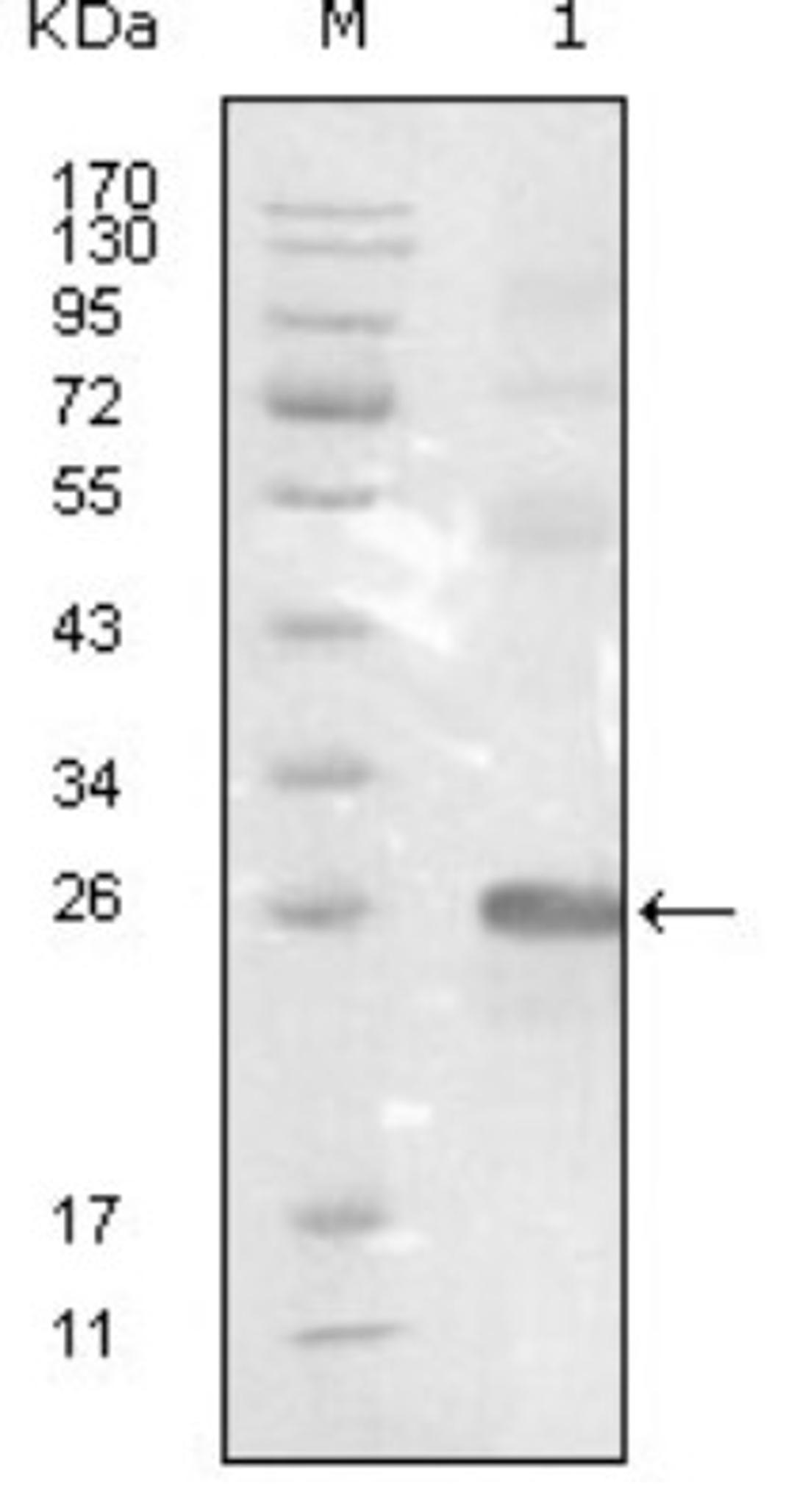 Western Blot: EphB3 Antibody (4A122D1) [NBP1-47522] - Analysis using EphB3 mouse mAb against truncated EphB3-His recombinant protein.