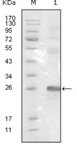 Western Blot: EphB3 Antibody (4A122D1) [NBP1-47522] - Analysis using EphB3 mouse mAb against truncated EphB3-His recombinant protein.