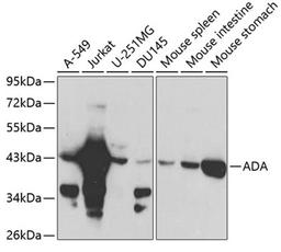 Western blot - ADA antibody (A1019)