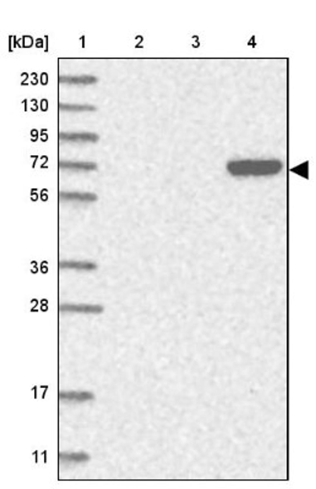 Western Blot: C6orf146 Antibody [NBP1-93471] - Lane 1: Marker [kDa] 230, 130, 95, 72, 56, 36, 28, 17, 11<br/>Lane 2: Human cell line RT-4<br/>Lane 3: Human cell line U-251MG sp<br/>Lane 4: Human plasma (IgG/HSA depleted)