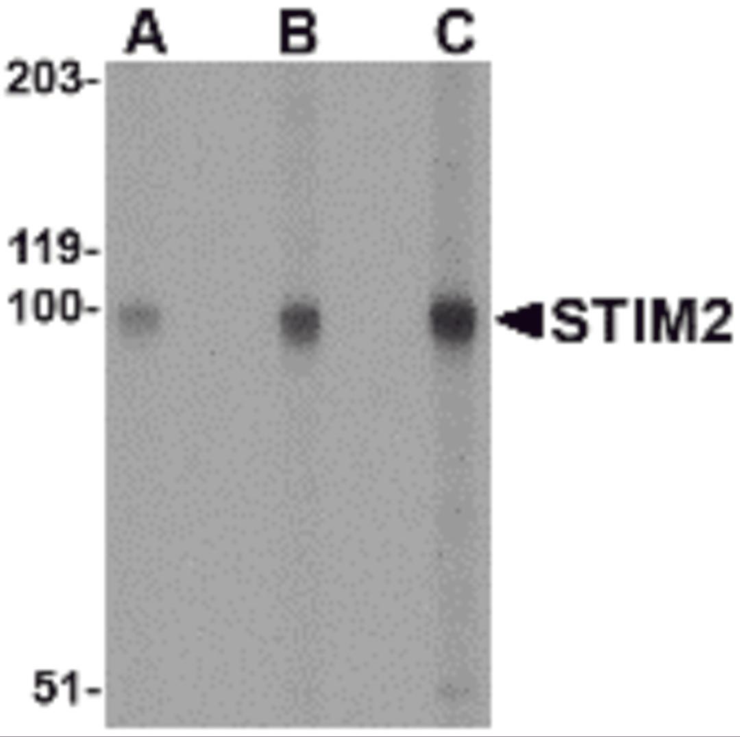 Western blot analysis of STIM2 in A-20 cell lysate with STIM2 antibody at (A) 0.5, (B) 1 and (C) 2 μg/mL.