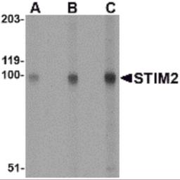 Western blot analysis of STIM2 in A-20 cell lysate with STIM2 antibody at (A) 0.5, (B) 1 and (C) 2 μg/mL.