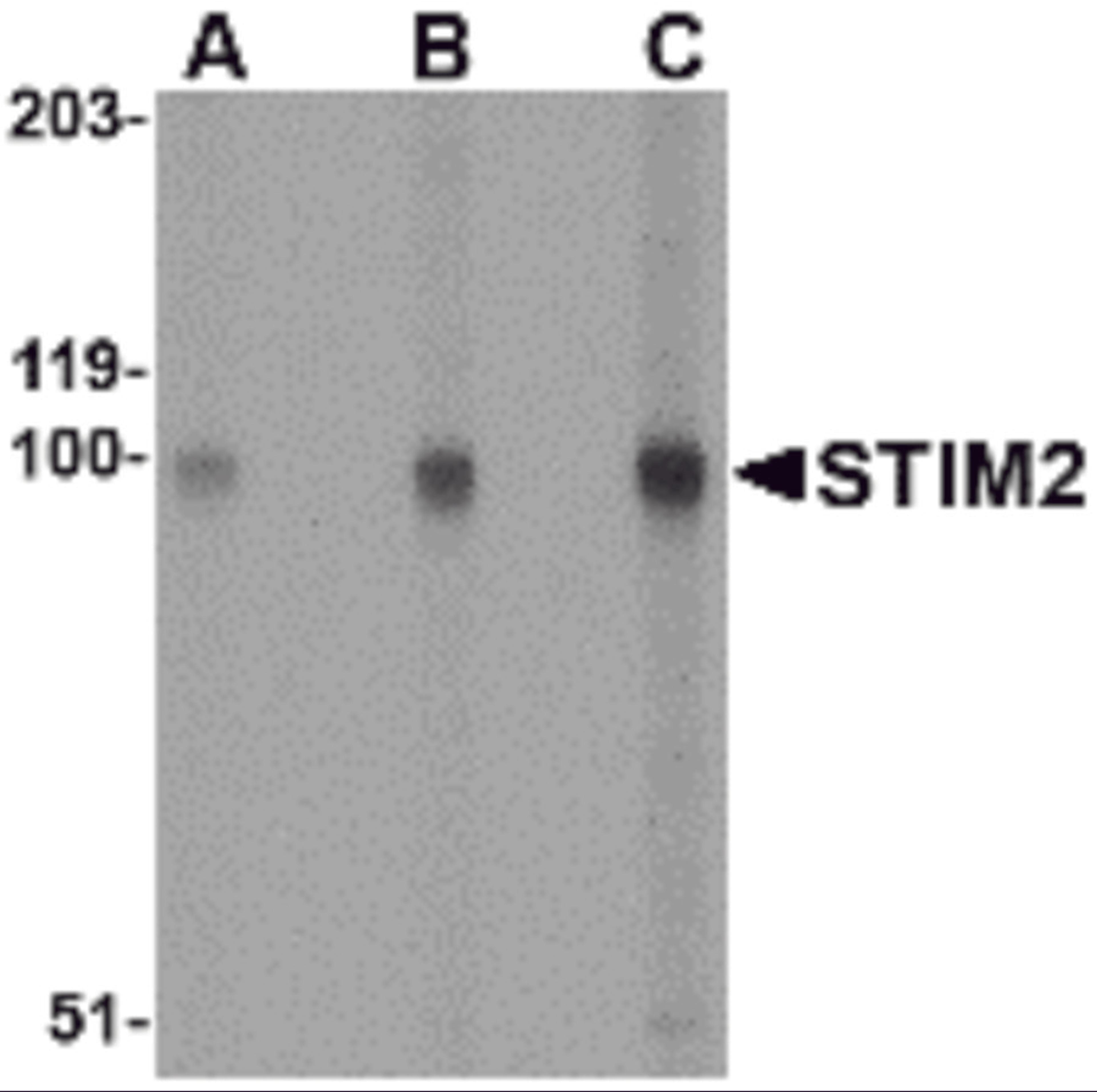 Western blot analysis of STIM2 in A-20 cell lysate with STIM2 antibody at (A) 0.5, (B) 1 and (C) 2 μg/mL.