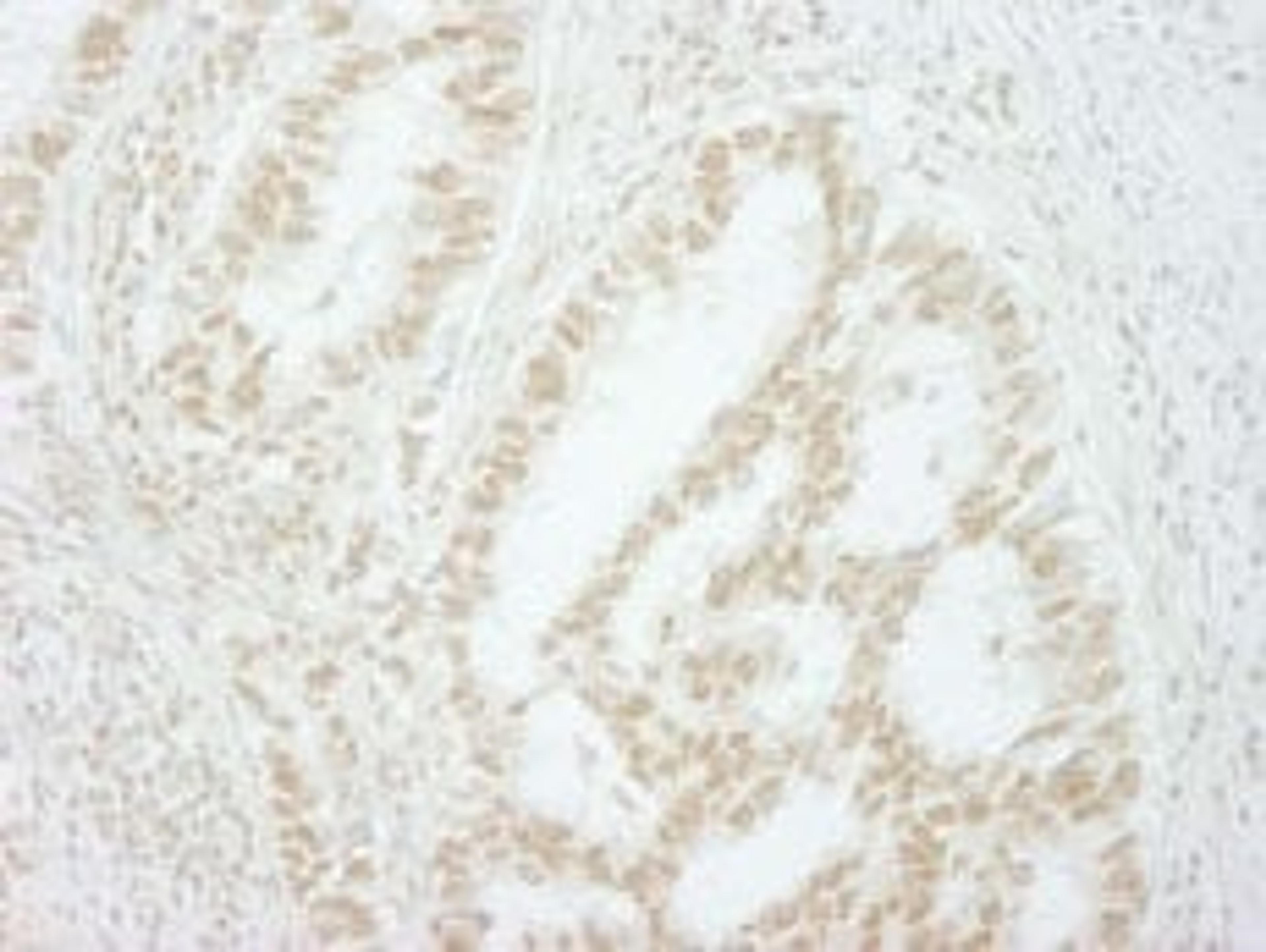 Detection of human MKRN2 by immunohistochemistry.