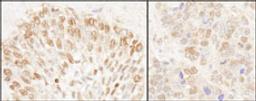 Detection of human and mouse NUP50 by immunohistochemistry.