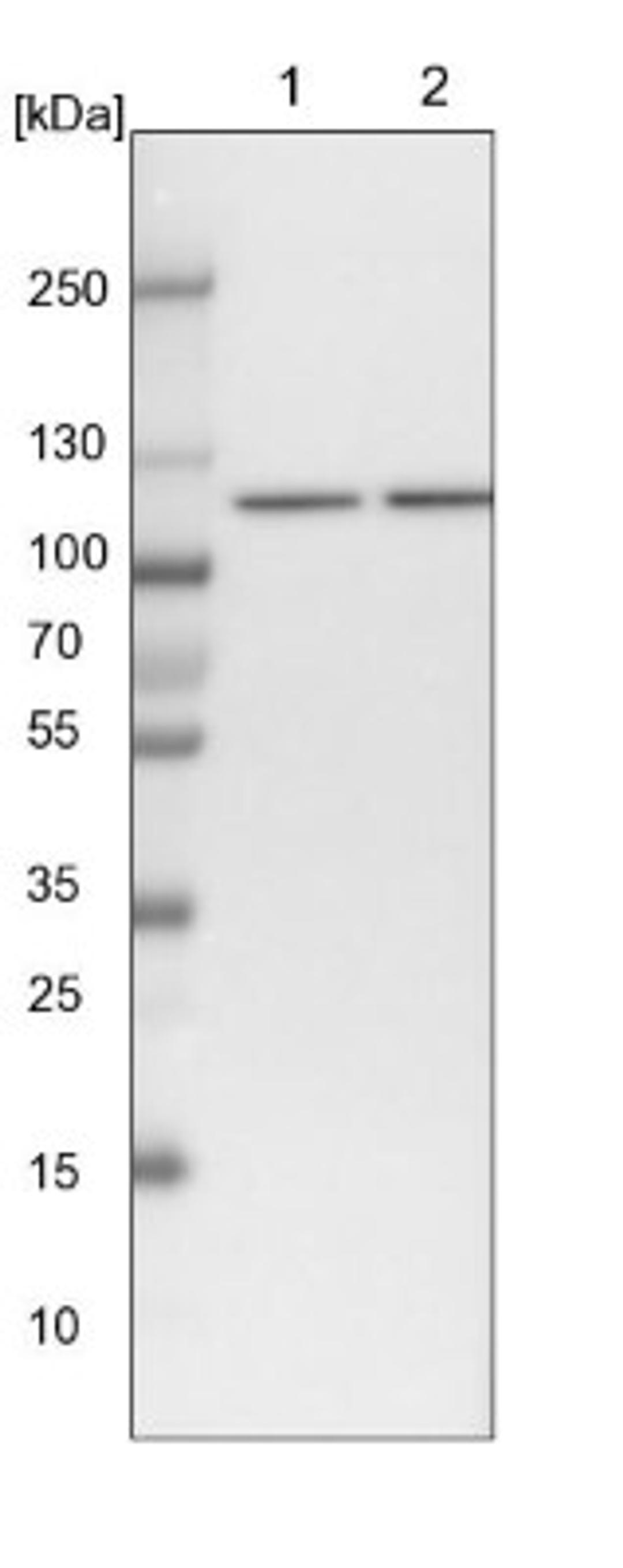 Western Blot: SART1 Antibody [NBP1-89023] - Lane 1: NIH-3T3 cell lysate (Mouse embryonic fibroblast cells)<br/>Lane 2: NBT-II cell lysate (Rat Wistar bladder tumour cells)