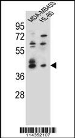 Western blot analysis in MDA-MB453,HL-60 cell line lysates (35ug/lane).