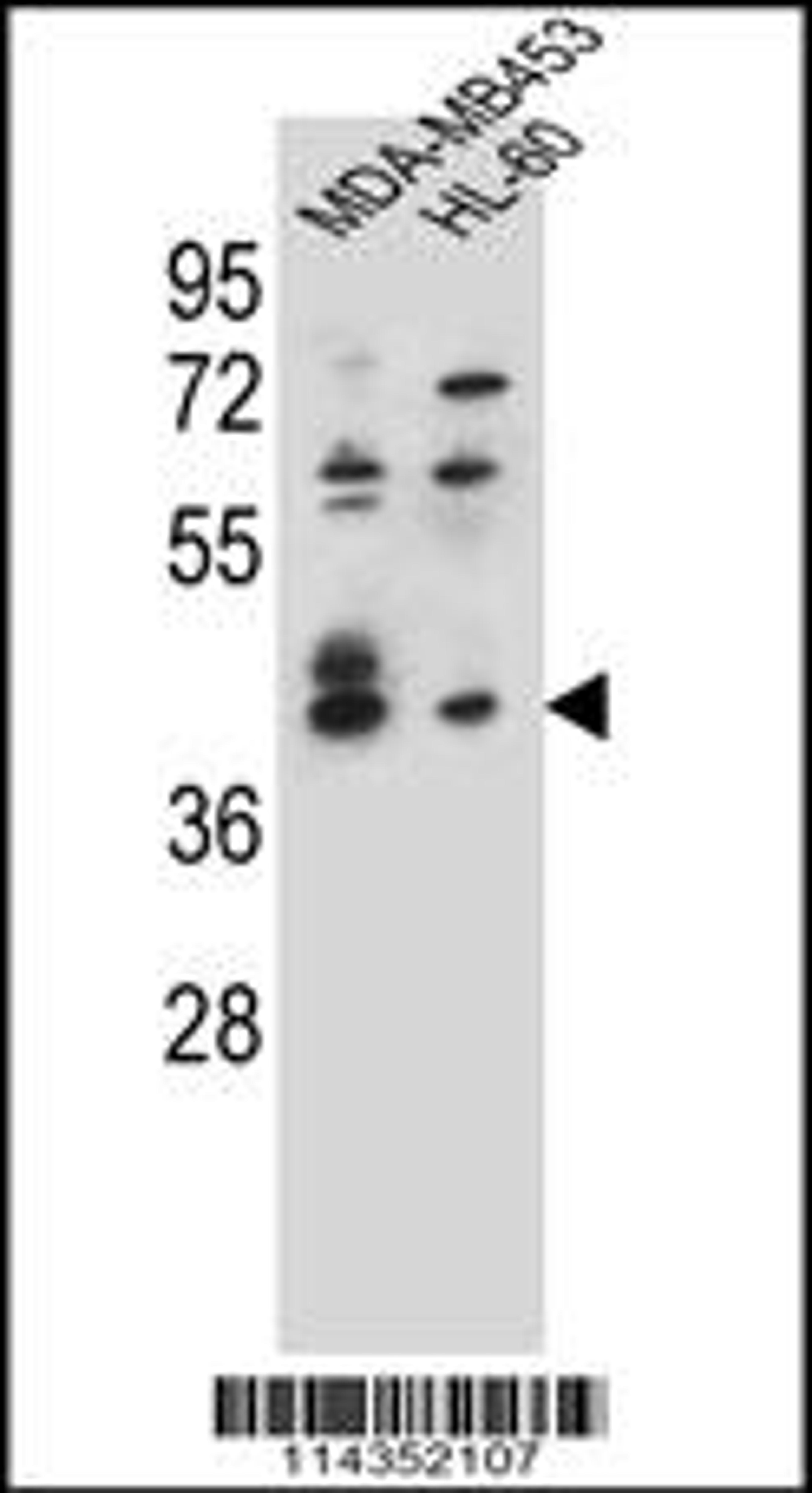 Western blot analysis in MDA-MB453,HL-60 cell line lysates (35ug/lane).