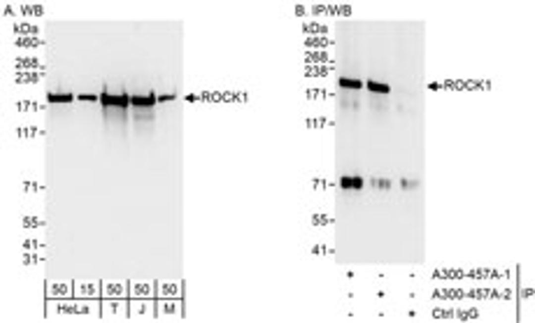 Detection of human and mouse ROCK1 by western blot and immunoprecipitation.