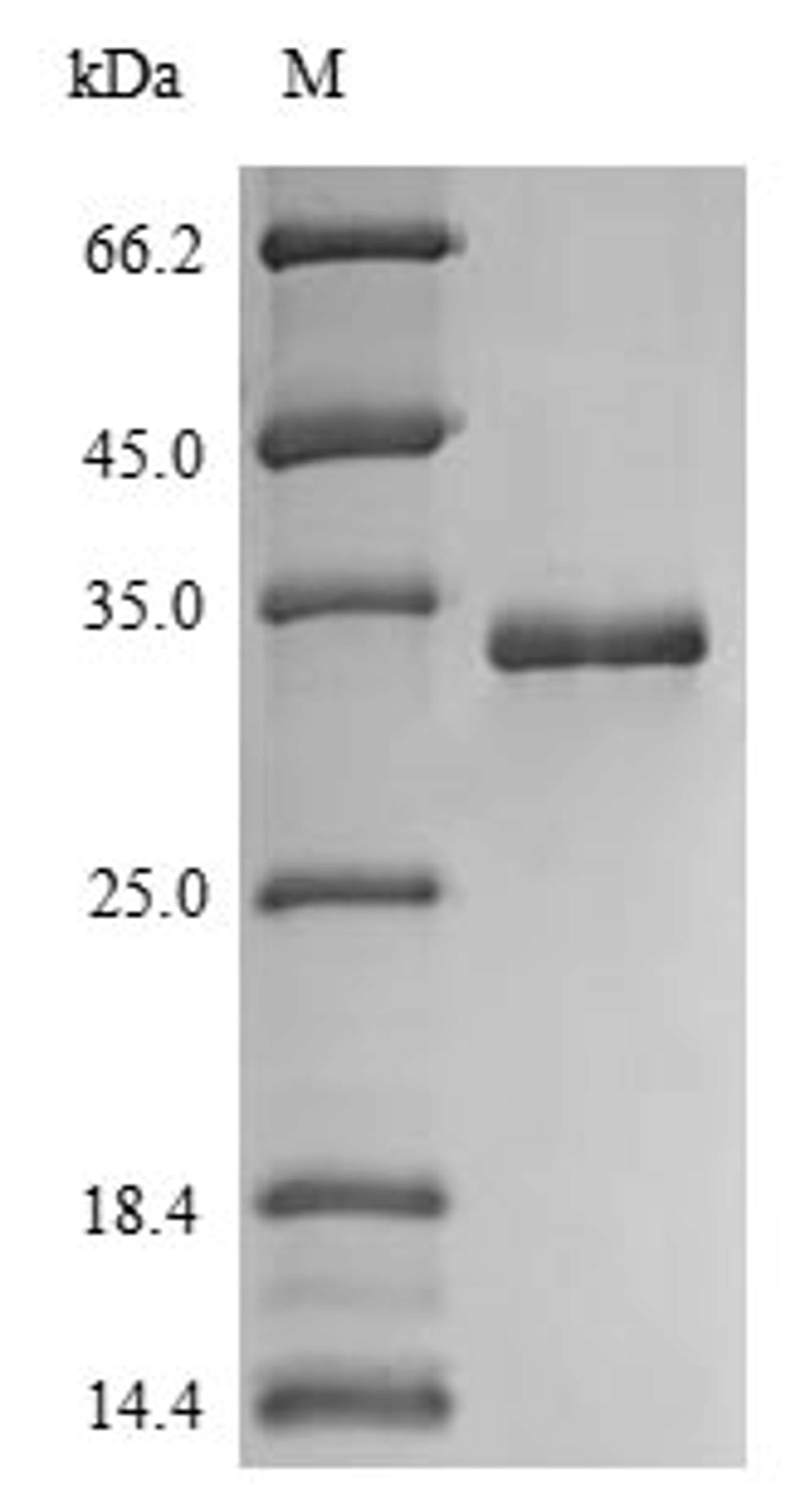 (Tris-Glycine gel) Discontinuous SDS-PAGE (reduced) with 5% enrichment gel and 15% separation gel.