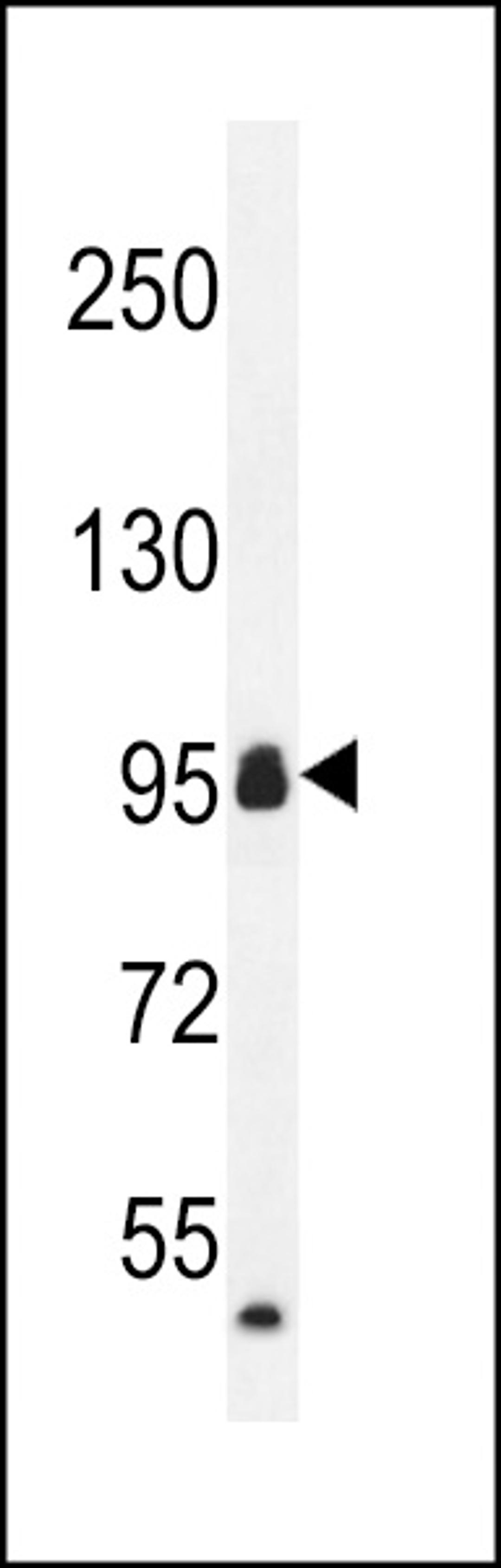 Western blot analysis in mouse heart tissue lysates (35ug/lane).