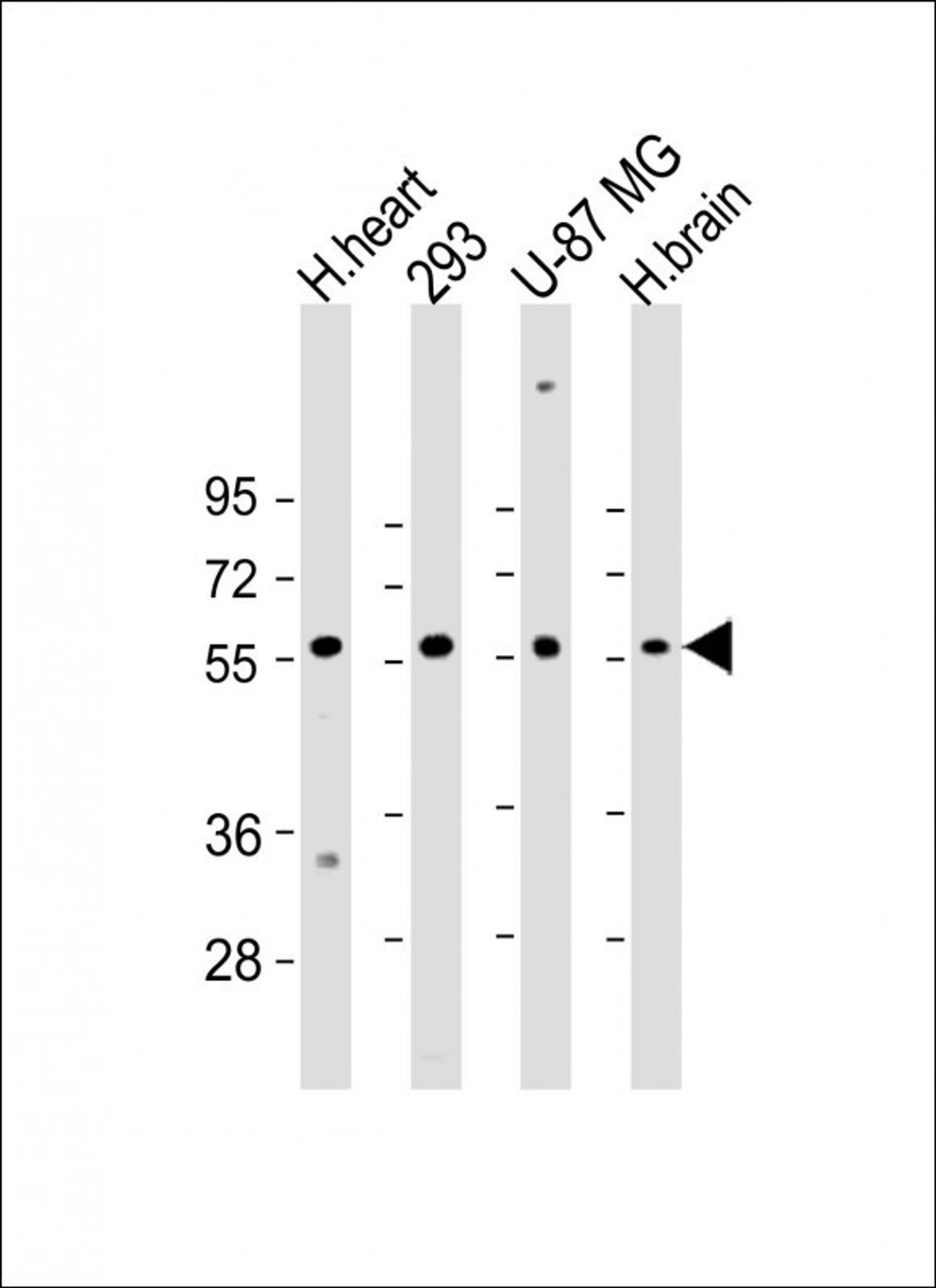 Western Blot at 1:2000 dilution Lane 1: H.heart lysate Lane 2: 293 whole cell lysate Lane 3: U-87 MG whole cell lysate Lane 4: H.brain whole cell lysate Lysates/proteins at 20 ug per lane.