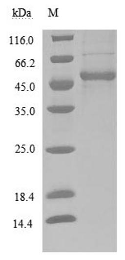 (Tris-Glycine gel) Discontinuous SDS-PAGE (reduced) with 5% enrichment gel and 15% separation gel.