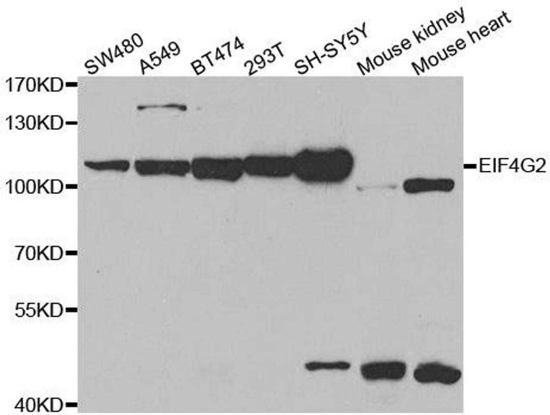 Western blot analysis of extracts of various cell lines using EIF4G2 antibody