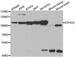 Western blot analysis of extracts of various cell lines using EIF4G2 antibody