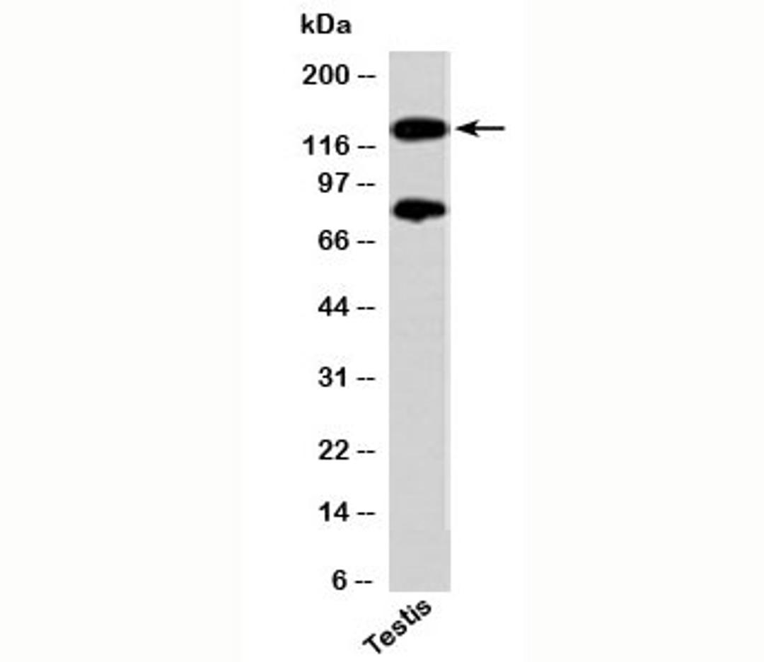 Western blot testing of human samples with PER2 antibody at 2ug/ml.