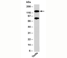 Western blot testing of human samples with PER2 antibody at 2ug/ml.