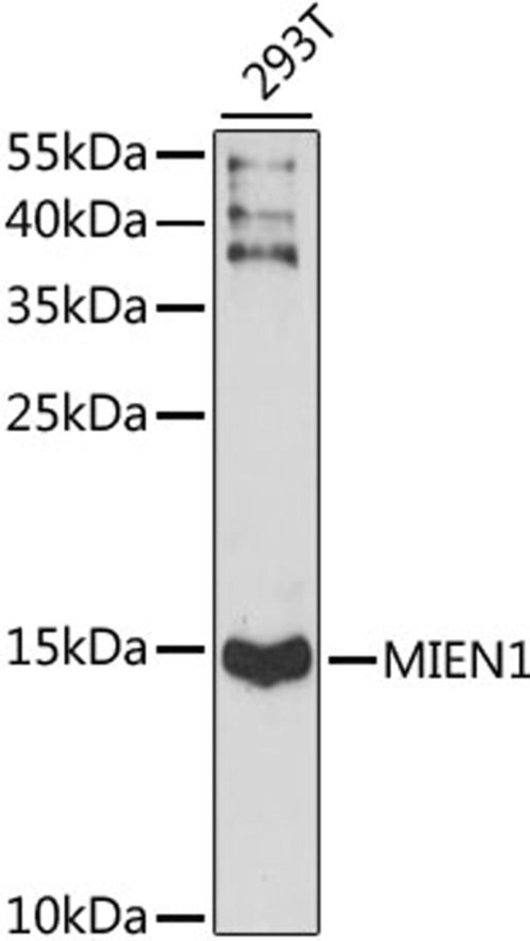 Western blot - MIEN1 antibody (A15535)