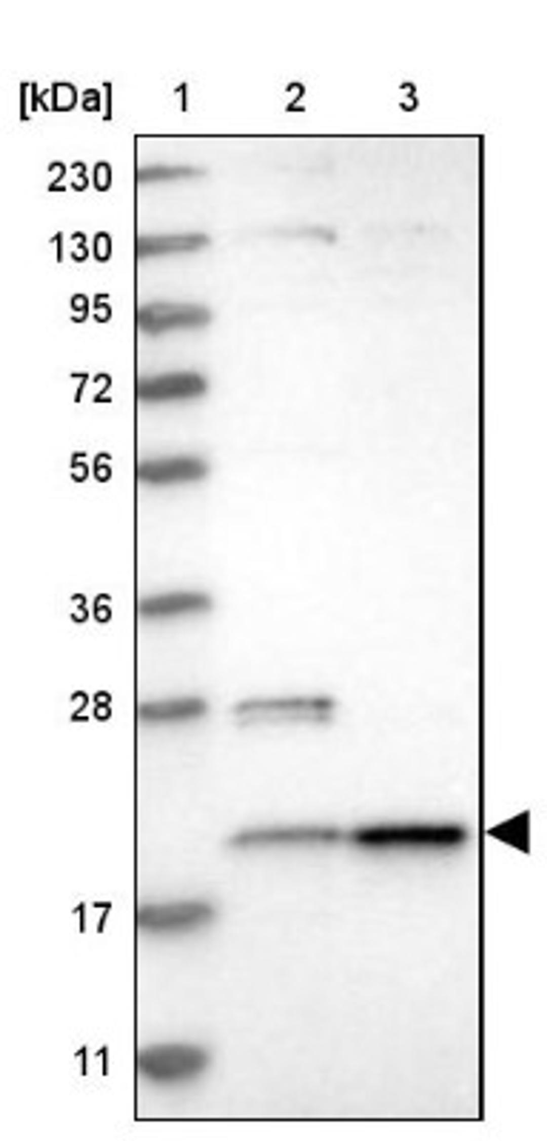 Western Blot: TMEM65 Antibody [NBP1-85970] - Lane 1: Marker [kDa] 230, 130, 95, 72, 56, 36, 28, 17, 11<br/>Lane 2: Human cell line RT-4<br/>Lane 3: Human cell line U-251MG sp