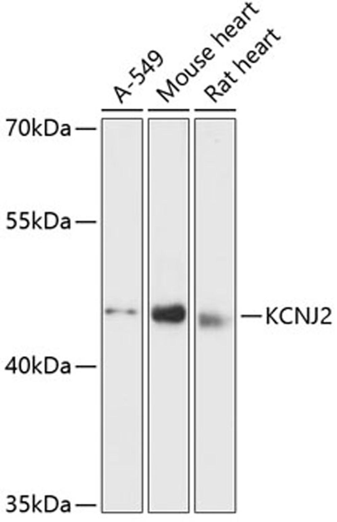 Western blot - KCNJ2 antibody (A12949)