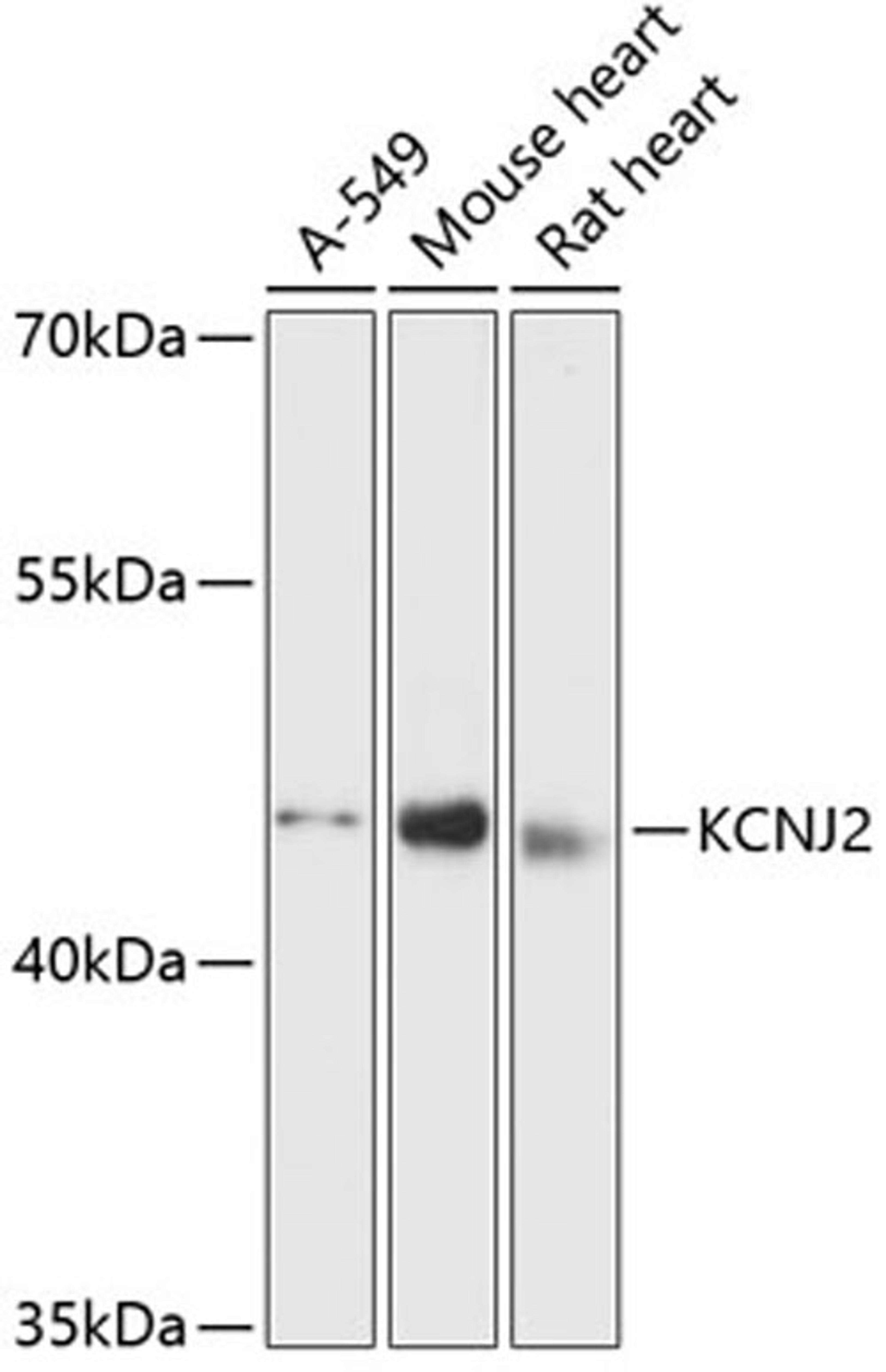 Western blot - KCNJ2 antibody (A12949)