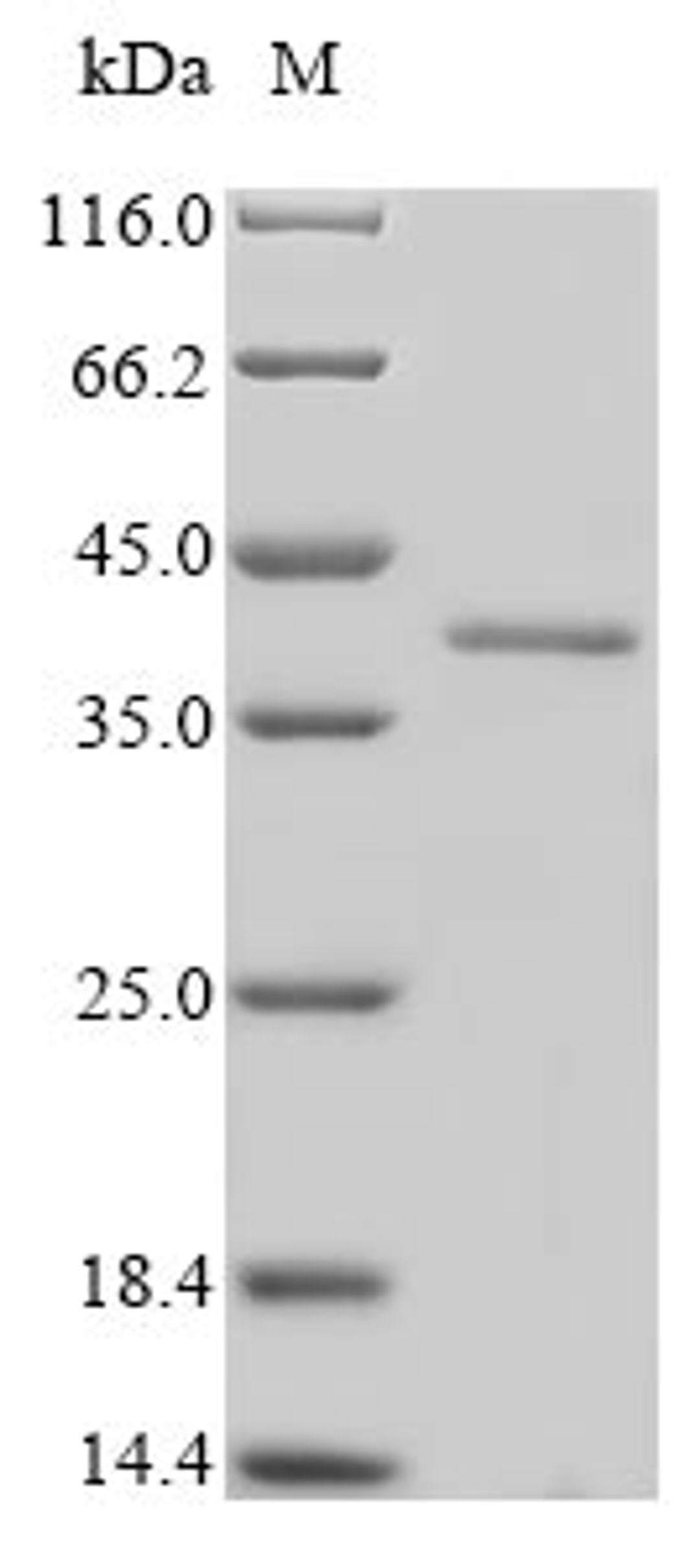 (Tris-Glycine gel) Discontinuous SDS-PAGE (reduced) with 5% enrichment gel and 15% separation gel.
