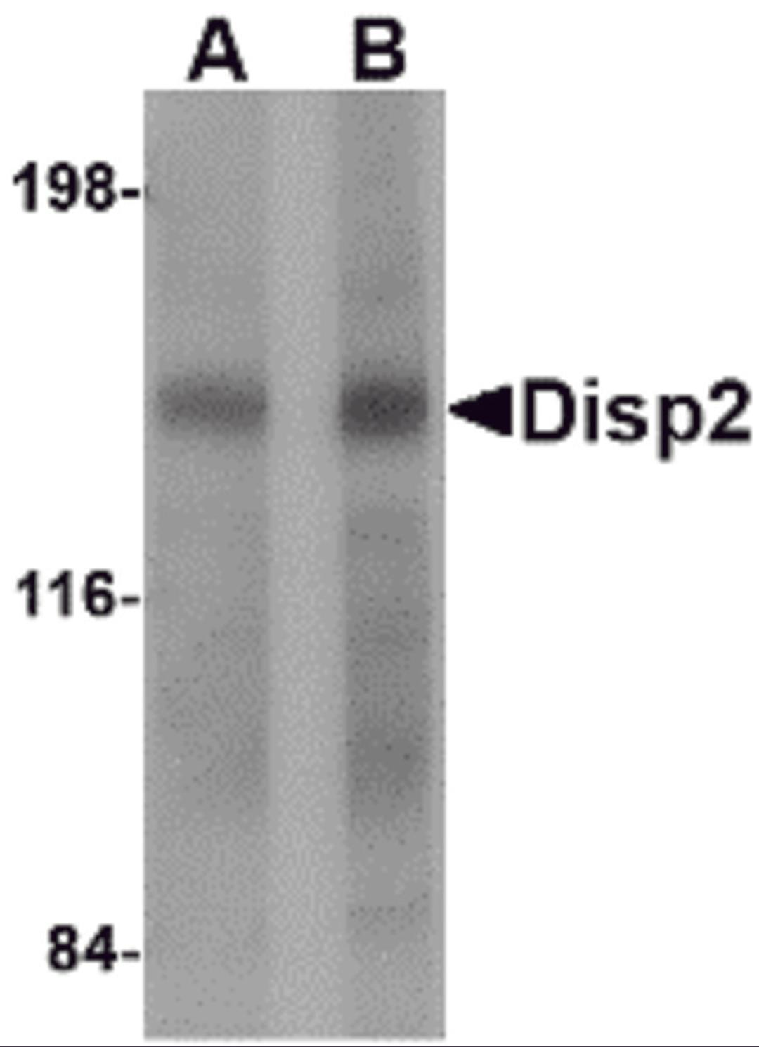 Western blot analysis of Disp2 in rat brain tissue lysate with Disp2 antibody at (A) 1 and (B) 2 &#956;g/mL.