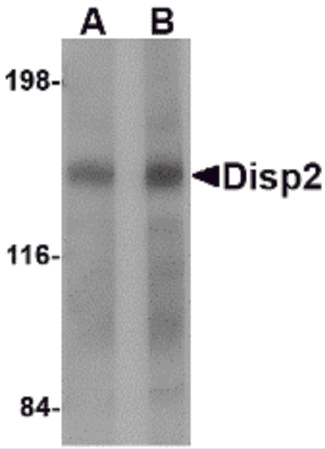 Western blot analysis of Disp2 in rat brain tissue lysate with Disp2 antibody at (A) 1 and (B) 2 μg/mL.