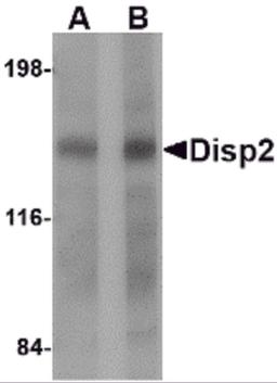 Western blot analysis of Disp2 in rat brain tissue lysate with Disp2 antibody at (A) 1 and (B) 2 μg/mL.