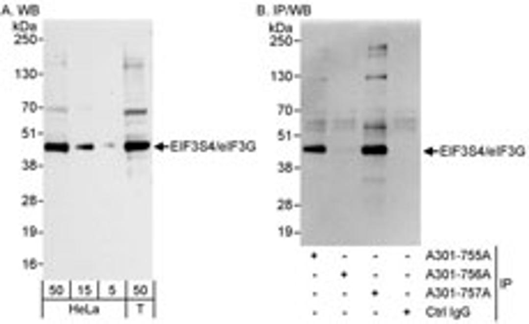 Detection of human eIF3G/EIF3S4 by western blot and immunoprecipitation.