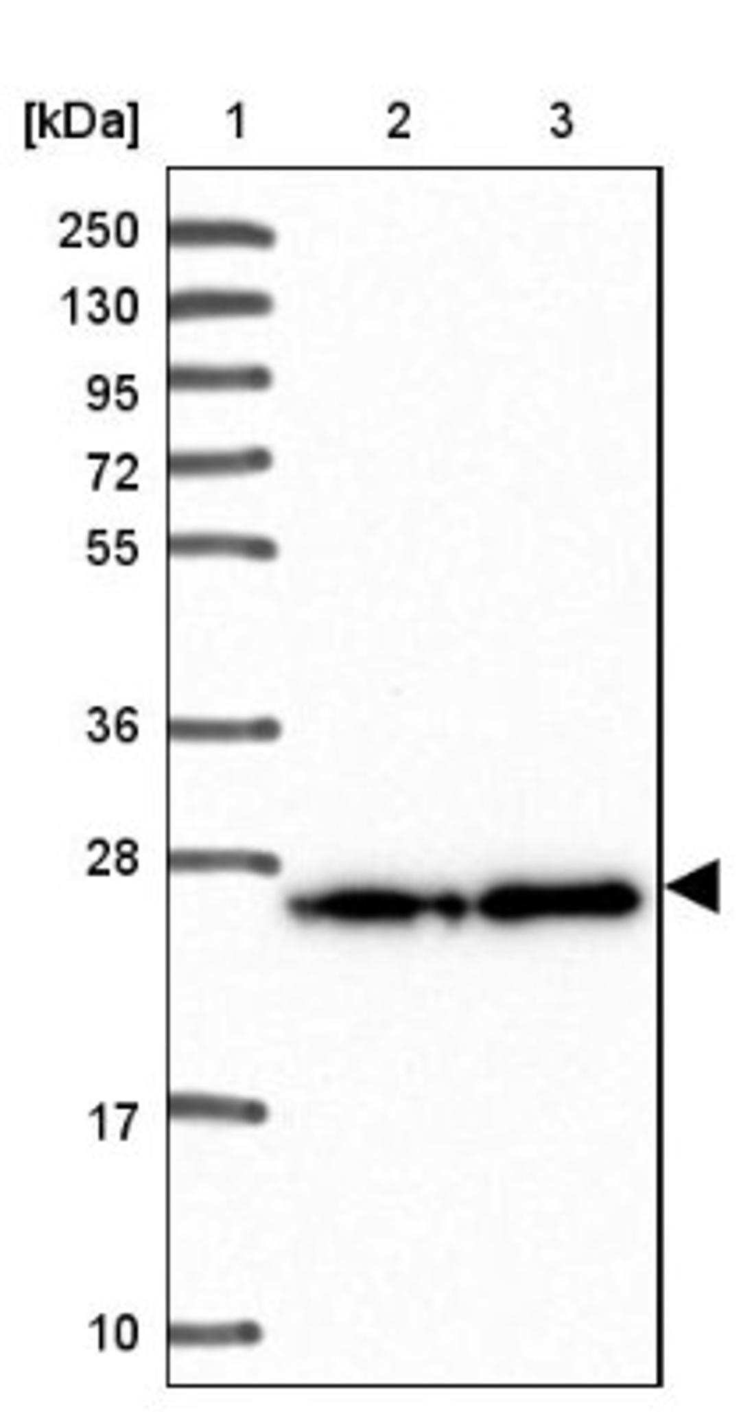 Western Blot: PDAP1 Antibody [NBP2-38621] - Lane 1: Marker [kDa] 250, 130, 95, 72, 55, 36, 28, 17, 10<br/>Lane 2: RT-4<br/>Lane 3: U-251 MG