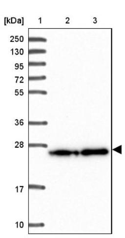 Western Blot: PDAP1 Antibody [NBP2-38621] - Lane 1: Marker [kDa] 250, 130, 95, 72, 55, 36, 28, 17, 10<br/>Lane 2: RT-4<br/>Lane 3: U-251 MG