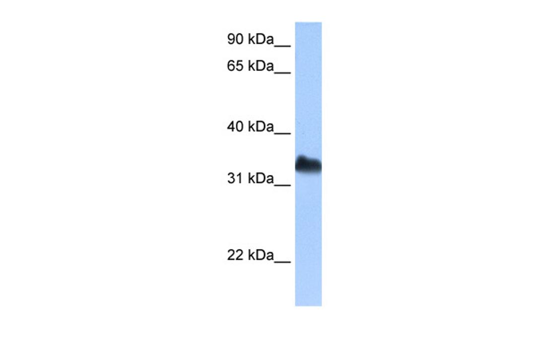 Antibody used in WB on Human Jurkat 0.2-1 ug/ml.