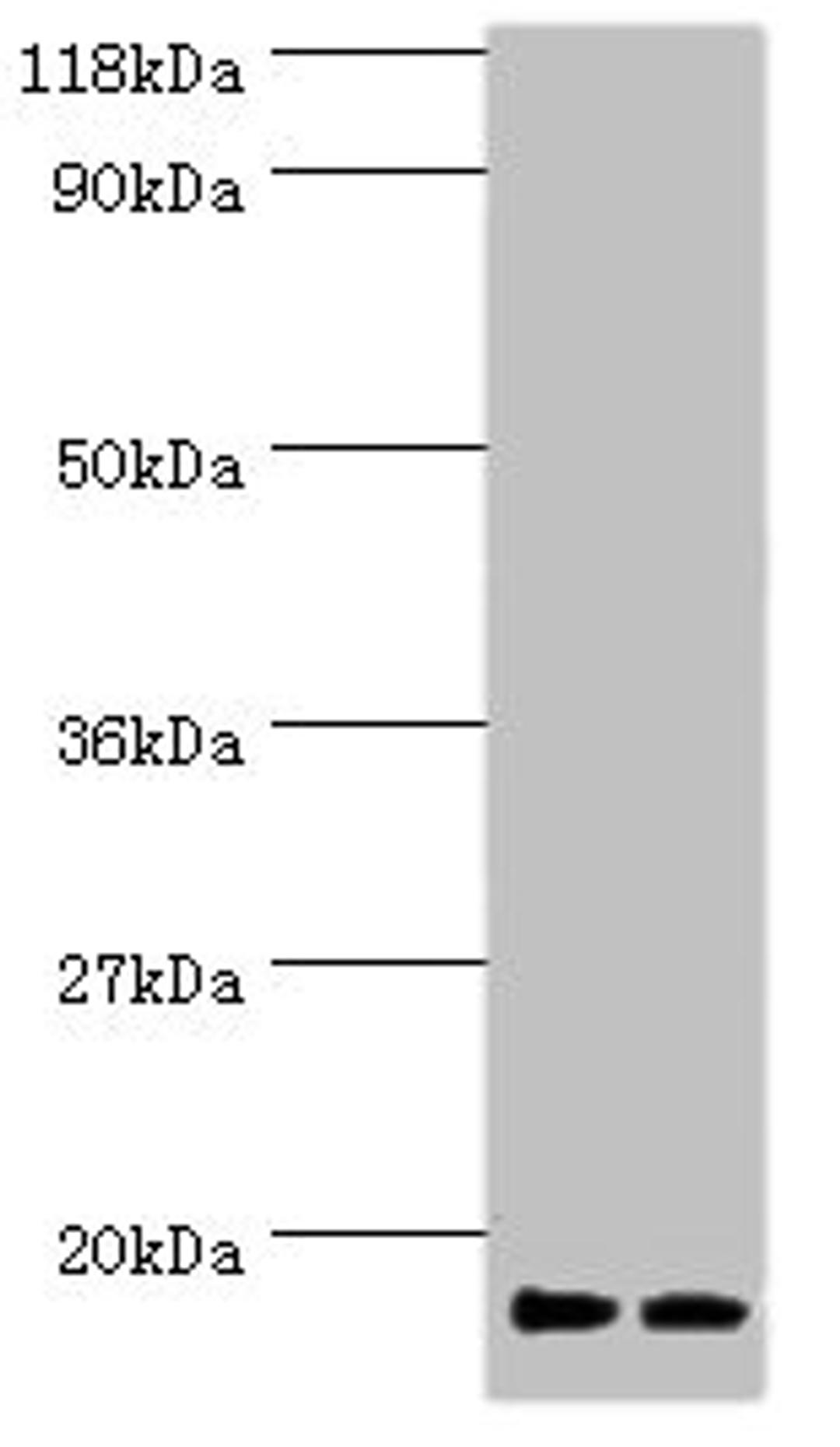 Western blot. All lanes: RPS19 antibody at 2µg/ml. Lane 1: EC109 whole cell lysate. Lane 2: 293T whole cell lysate. Secondary. Goat polyclonal to rabbit IgG at 1/15000 dilution. Predicted band size: 17 kDa. Observed band size: 17 kDa